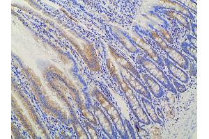 Immunohistochemistry (IHC) image for anti-Ephrin B2 (EFNB2) (C-Term) antibody (ABIN6261455)