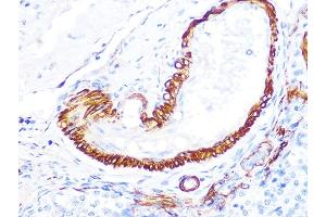Immunohistochemistry of paraffin-embedded rat ovary using LDHB Rabbit mAb (ABIN7268170) at dilution of 1:100 (40x lens).