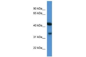 WB Suggested Anti-Centa1 Antibody Titration: 0.