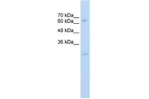 WB Suggested Anti-CES2 Antibody Titration:  0.