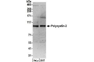 Western Blotting (WB) image for anti-Polycystic Kidney Disease 2 (Autosomal Dominant) (PKD2) (AA 918-968) antibody (ABIN7451972)