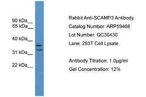 WB Suggested Anti-SCAMP3  Antibody Titration: 0. (SCAMP3 antibody  (N-Term))