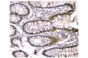 IHC analysis of CA2 using anti-CA2 antibody (ABIN6719533). (CA2 antibody  (AA 2-260))