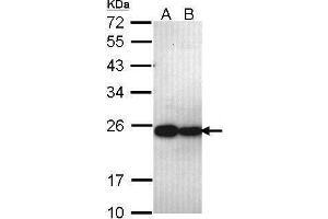 WB Image Sample (30 ug of whole cell lysate) A: A431 , B: H1299 12% SDS PAGE antibody diluted at 1:1000 (PSMB5 antibody  (C-Term))