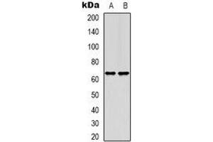 Western blot analysis of TIGD1 expression in HEK293T (A), Hela (B) whole cell lysates. (TIGD1 antibody)
