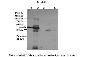 Lanes:   1:1ug insoluble STUB1 protein, 2:1ug soluble STUB1 protein, 3:1ug EPM2A protein, 4:1ug insoluble PPP1R3C protein, 5:1ug soluble PPP1R3C protein  Primary Antibody Dilution:   1:2500  Secondary Antibody:   Anti-rabbit-AP  Secondary Antibody Dilution:   1:20,000  Gene Name:   STUB1  Submitted by:   Pedro Castanheira, Biocant (STUB1 antibody  (N-Term))