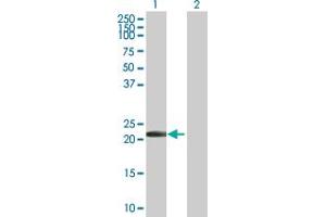 Western Blot analysis of PYCARD expression in transfected 293T cell line by PYCARD MaxPab polyclonal antibody. (PYCARD antibody  (AA 1-195))