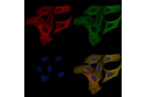 ABIN6258077 and ABIN6275814 staining Hela cells by IF/ICC.
