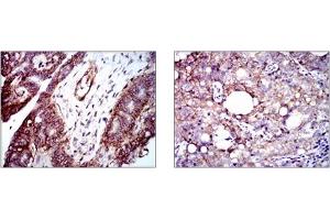 Immunohistochemistry (IHC) image for anti-Integrin beta 1 (ITGB1) antibody (ABIN1106231) (ITGB1 antibody)