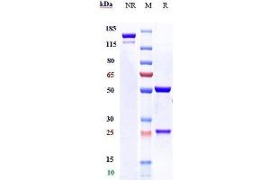 Anti-CALCRL / CGRPR Reference Antibody (erenumab) on SDS-PAGE under reducing (R) condition. (Recombinant CALCRL (Erenumab Biosimilar) antibody)