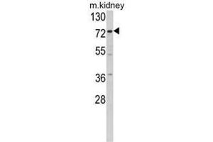 Western blot analysis of Villin-1 Antibody (N-term) in mouse kidney tissue lysates (35ug/lane).