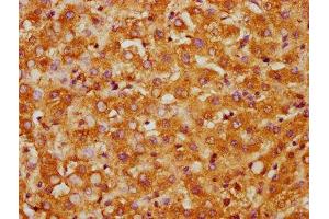 IHC image of ABIN7146870 diluted at 1:300 and staining in paraffin-embedded human liver tissue performed on a Leica BondTM system. (CSNK1G1 antibody  (Isoform gamma 1))