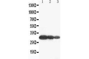 Anti-Aquaporin 6 antibody, Western blotting Lane 1: U87 Cell Lysate Lane 2: COLO320 Cell Lysate Lane 3: MCF-7 Cell Lysate (AQP6 antibody  (C-Term))