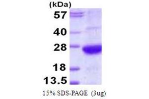 SDS-PAGE (SDS) image for alpha 1 Microglobulin/bikunin precursor (AMBP) (AA 20-203) protein (His tag) (ABIN667966) (AMBP Protein (AA 20-203) (His tag))