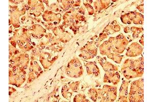 IHC image of ABIN7151293 diluted at 1:500 and staining in paraffin-embedded human pancreatic tissue performed on a Leica BondTM system. (UBR1 antibody  (AA 722-862))