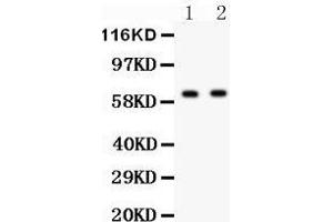 Anti- HEXB antibody, Western blotting All lanes: Anti HEXB  at 0. (HEXB antibody  (AA 381-556))