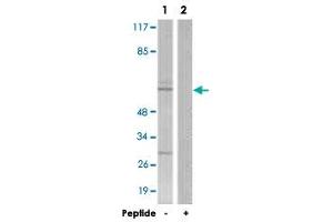 Western blot analysis of extracts from COS-7 cells, using NR4A1 polyclonal antibody .