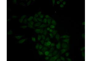 Immunofluorescence analysis of MCF-7 cell using CTSE antibody. (Cathepsin E antibody)