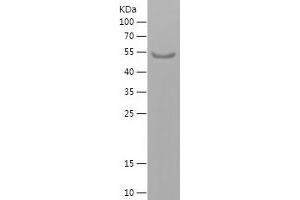 Western Blotting (WB) image for Transforming, Acidic Coiled-Coil Containing Protein 2 (TACC2) (AA 1833-2071) protein (His tag) (ABIN7125461) (TACC2 Protein (AA 1833-2071) (His tag))