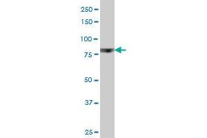 RPS6KA6 monoclonal antibody (M03), clone 8H5 Western Blot analysis of RPS6KA6 expression in PC-12 . (RPS6KA6 antibody  (AA 636-745))