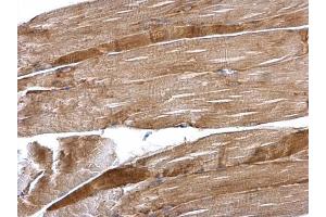 Immunohistochemistry (IHC) image for anti-Desmin (DES) antibody (ABIN2855655)