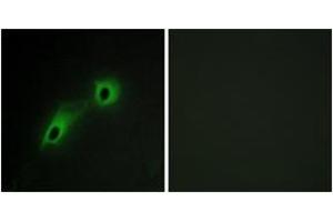 Immunofluorescence analysis of HeLa cells, using CAMK5 Antibody. (CAMKV antibody  (AA 211-260))