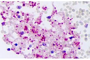Anti-PPBP antibody IHC staining of human intravascular platelets. (CXCL7 antibody)