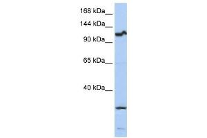 OSMR antibody used at 1 ug/ml to detect target protein. (Oncostatin M Receptor antibody  (Middle Region))