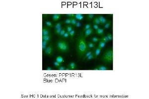 Sample Type :  Human lung adenocarcinoma cell line A549  Primary Antibody Dilution :  1:100  Secondary Antibody :  Goat anti-rabbit AlexaFluor 488  Secondary Antibody Dilution :  1:400  Color/Signal Descriptions :  PPP1R13L: Green DAPI:Blue  Gene Name :  PPP1R13L   Submitted by :  Dr.
