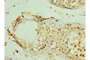 Immunohistochemistry of paraffin-embedded human testis tissue using ABIN7159289 at dilution of 1:100 (MAGEC2 antibody  (AA 1-150))