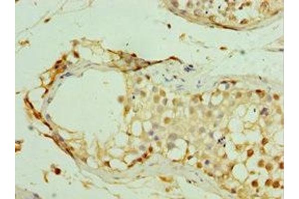 MAGEC2 antibody  (AA 1-150)