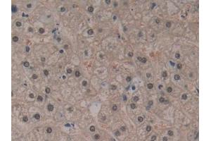 Detection of SDH in Human Liver Tissue using Polyclonal Antibody to Sorbitol Dehydrogenase (SDH) (SORD antibody  (AA 98-355))