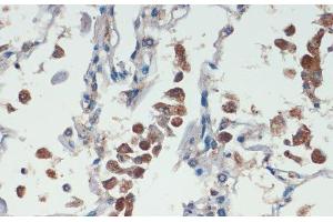 Immunohistochemistry of paraffin-embedded Human lung using APC Polyclonal Antibody at dilution of 1:200 (40x lens). (APC antibody)