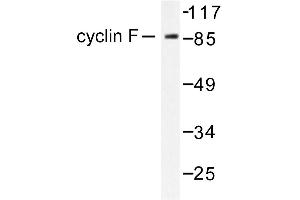 Image no. 1 for anti-Cyclin F (CCNF) antibody (ABIN265381) (Cyclin F antibody)