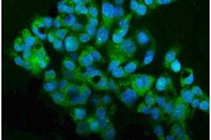 anti-Matrix Metallopeptidase 15 (Membrane-inserted) (MMP15) (AA 132-202) antibody