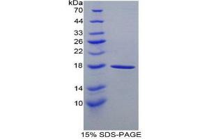 SDS-PAGE (SDS) image for Calmodulin 1 (Calm1) (AA 1-149) protein (His tag) (ABIN2120705) (Calmodulin 1 Protein (Calm1) (AA 1-149) (His tag))