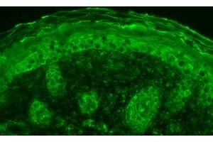 SPC108 Anti Calnexin CT, mouse backskin. (Calnexin antibody  (C-Term))