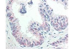 Immunohistochemistry of Mouse anti-AKT pS473 antibody. (AKT1 antibody  (pSer473))