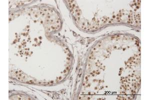 Immunoperoxidase of monoclonal antibody to FLJ20097 on formalin-fixed paraffin-embedded human testis. (Syndetin/VPS50 antibody  (AA 862-964))