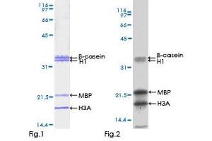 STK33 Protein (AA 1-514) (GST tag)