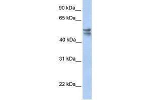TRMU antibody used at 1 ug/ml to detect target protein.