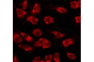 ABIN6278615 staining HepG2 by IF/ICC. (OR5M3 antibody)