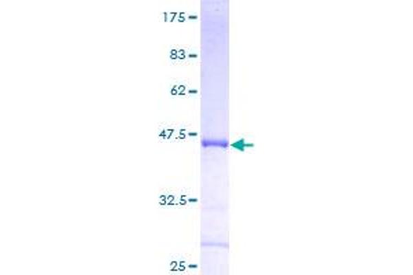CDKN3 Protein (AA 1-172) (GST tag)
