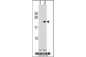 Western blot analysis of PLA2G12A using rabbit polyclonal PLA2G12A Antibody using 293 cell lysates (2 ug/lane) either nontransfected (Lane 1) or transiently transfected (Lane 2) with the PLA2G12A gene. (PLA2G12A antibody  (AA 55-83))