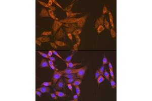 Immunofluorescence analysis of NIH-3T3 cells using USP9X Rabbit mAb (ABIN7271169) at dilution of 1:100 (40x lens). (USP9X antibody)