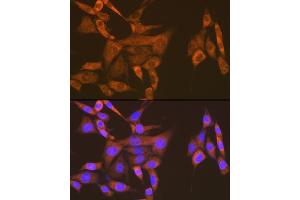 Immunofluorescence analysis of NIH-3T3 cells using USP9X Rabbit mAb (ABIN7271169) at dilution of 1:100 (40x lens). (USP9X antibody)