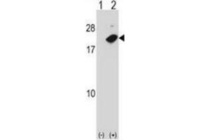 Western blot analysis of NUDT2 (arrow) using NUDT2 / APAH1 Antibody : 293 cell lysates (2 ug/lane) either nontransfected (Lane 1) or transiently transfected (Lane 2) with the NUDT2 gene.