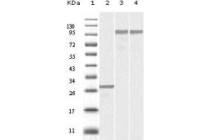 Western blot analysis using Dynamin2 mouse mAb against truncated Dynamin-2 recombinant protein (1), SKN-SH cell lysate (2) and NIH/3T3 cell lysate (3). (DNM2 antibody)