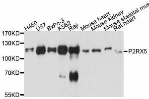 Western blot analysis of extracts of various cell lines, using P2RX5 antibody. (P2RX5 antibody  (AA 341-422))