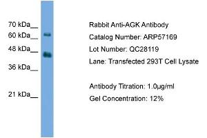 WB Suggested Anti-AGK  Antibody Titration: 0.